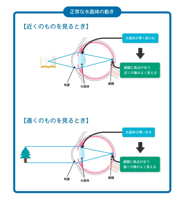 正常な水晶体の動き