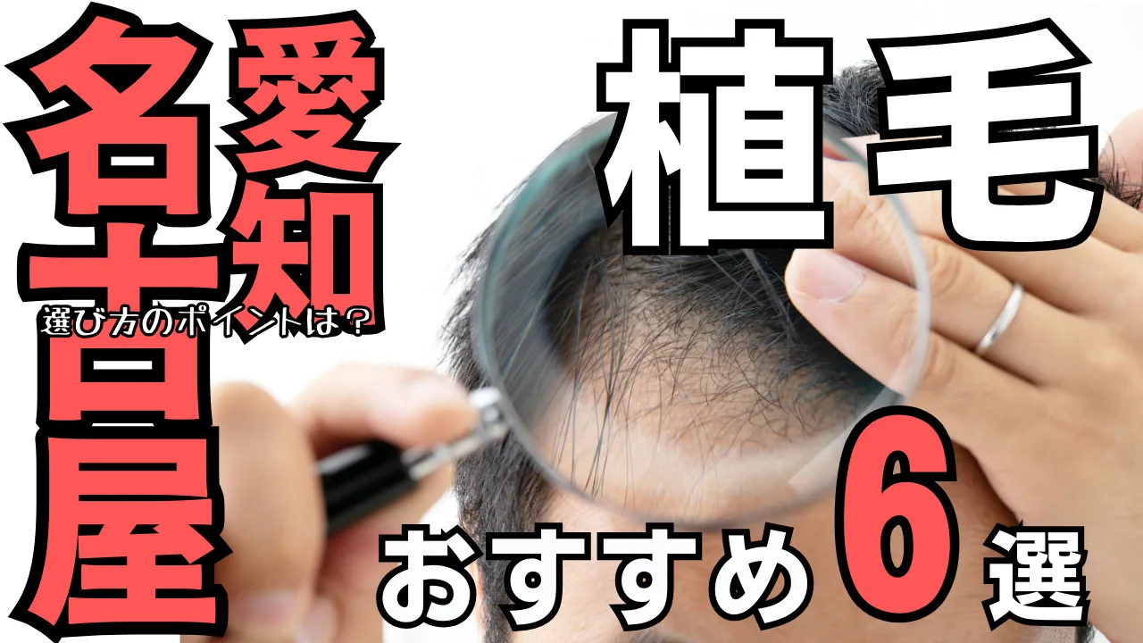 名古屋おすすめ植毛クリニック６選！後悔しない選び方を解説